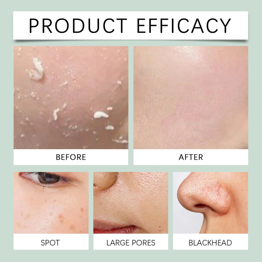 Maycheer Herbal Exfoliating Brightening Gel ( BUY 1 GET 1 FREE )