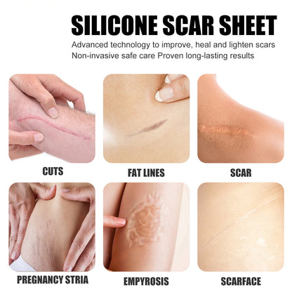 Laniska Silicone Scar Sheets ( BUY 1 GET 1 FREE )